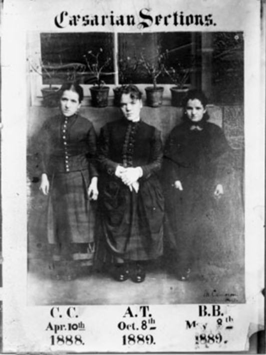 Cameron's first three patients. Courtesy Glasgow University/Heatherbank Museum of Social Work